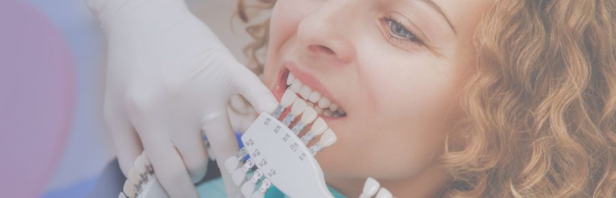 Preguntas frecuentes sobre carillas dentales