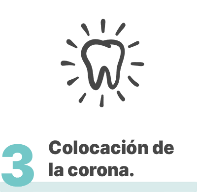 Colocación de corona dental