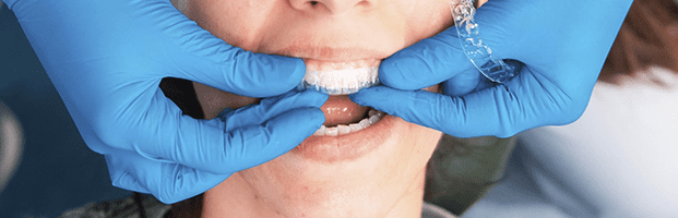 consejos para cuidar tu salud bucal en vacaciones de la clínica dental ortoinvisible en valladolid